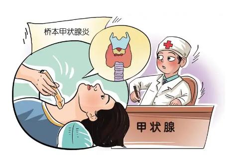 公务员体检发现桥本甲状腺炎，体检不合格我该如何应对？