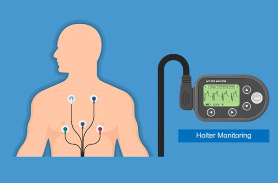 入职体检心电图显示ST改变怎么办？体检该如何通过？