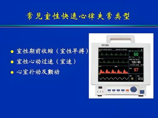 心律失常公务员体检不合格，有过关通过的办法吗？